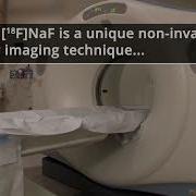 Input Function And Modeling For Determining Bone Metabolic Flux Using 18F NaF PET Imaging