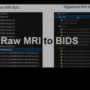 Организация данных нейровизуализации Часть 1 МРТ