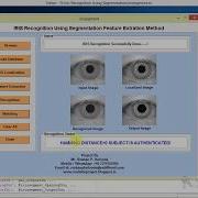 Iris Recognition Using Segmentation Feature Extraction Matlab Project With Source Code