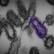 What Made The 1918 Flu Pandemic So Deadly