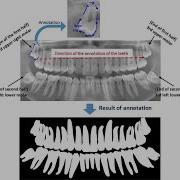 SIBGRAPI 2020 A Study On Tooth Segmentation And Numbering Using End To End Deep Neural Networks