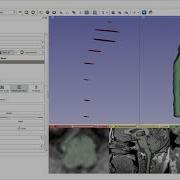 Quick Manual Segmentation With Contour Interpolation