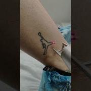 Safe Tattoo Removal Wit Picosecond Laser Shorts