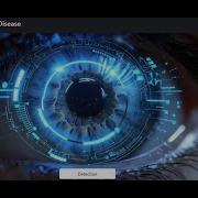 Iris Detection For Eye Disease Using Machine Learning And Flask Web Application Python Project