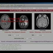 Multimodal Image Fusion Using Matlab Project With Source Code Multimodal Image Fusion Matlab Code