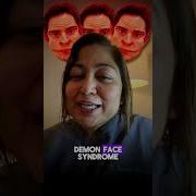 Doctor Explains Demon Face Syndrome