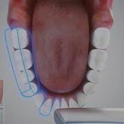 3M True Definition Scanner ALT Full Arch Animation