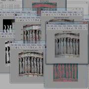 Image Forgery Detection Using Adaptive Over Segmentation And Feature Point Matching Matlab Projects