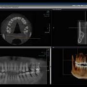 Часть 2 Программное обеспечение для 3D КТ по запросу Построение дуги зуба Автор д р Халед Э