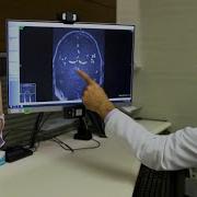 Mayo Clinic Minute What Is A Subarachnoid Hemorrhage