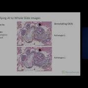 Artificial Intelligence And Digital Pathology Making The Most Of Limited Annotated Data