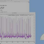 EKG Demo 41 1