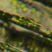 Microscope View Of Plant Cells