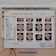 Final Year Project On Malaria Cell Detection In Image PYTHON Web APP MyProjects Mart
