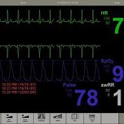 Introduction Of LLEAP Patient Monitors