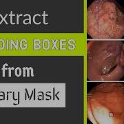 Extracting Bounding Box From Binary Segmentation Mask UNET Image Segmentation Python OpenCV