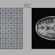 Least Squares Optimal Density Compensation For Gridding