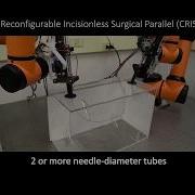 Design Optimization Of A Parallel Surgical Robot