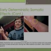 RADT 086 Early Deterministic Radiation Effects