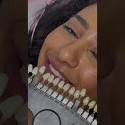 Teeth Whitening Process Teethwhiteningprocedure Teethwhiteningbusiness Teethwhiting
