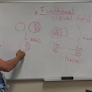 Functional Visual Fields