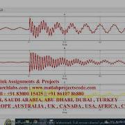 Design Of Fault Current Limiter Using Thyristor Matlab Simulink Simulink