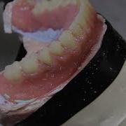 Полные съемные протезы выборочная шлифовка шаг за шагом