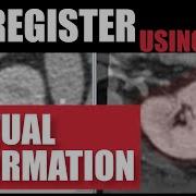 FireVoxel Tutorial 13 3D Image Coregistration With Mutual Information And AutoFocus