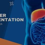 Automatic Liver Segmentation Using PyTorch And Monai