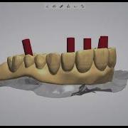 3Shape And ICAM Bullard Dental
