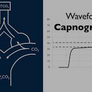 Waveform Capnography BAVLS
