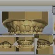 DIGITAL STUDY MODELS DIGITAL STUDY MODELS VIEWING USER GUIDE