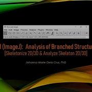 FIJI ImageJ Analysis Of Branched Structures Skeletonize 2D 3D Analyze Skeleton 2D 3D