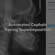 WebCeph Automated Cephalo Tracing Superimposition