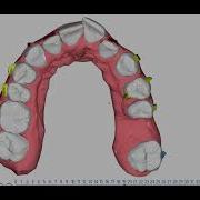 Onyxceph Smart Staging