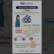 Sydenham Chorea Neurological Manifestation Of Acute Rheumatic Fever