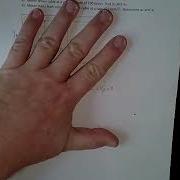 Dependent Motion Example 1
