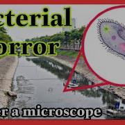 ZOOM 1000X River Water Under A Microscope