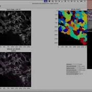 Segmenting Cells In Out Of Focus Images In CellProfiler AskErinDearBeth Episode 1