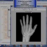 Image Quality Assessment For Fake Biometric Detection Application
