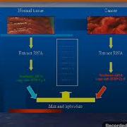 Lecture Diagnostic Molecular Biology Microarray Techology