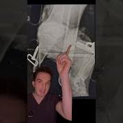 Can You Spot The Subtle Injury On This X Ray