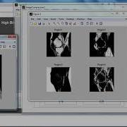Image Processing Project Topics In Matlab Image Processing Thesis Topics In Matlab