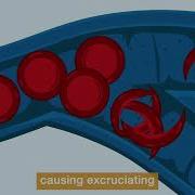 Sickle Cell Disease What You Need To Know