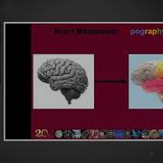 Brain Metastasis A Cancer Neuroscience Perspective