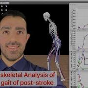 Musculoskeletal Biomechanics Analysis Of Walking Gait Of Post Stroke By OpenSim