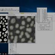 Introduction To Image Analysis With ImageJ Segmentation Threshold