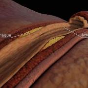 LDL And HDL Cholesterol Good And Bad Cholesterol Nucleus Health