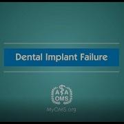 Dental Implant Failure