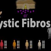 Cystic Fibrosis Pathophysiology Genetics Symptoms Diagnosis And Treatments Animation